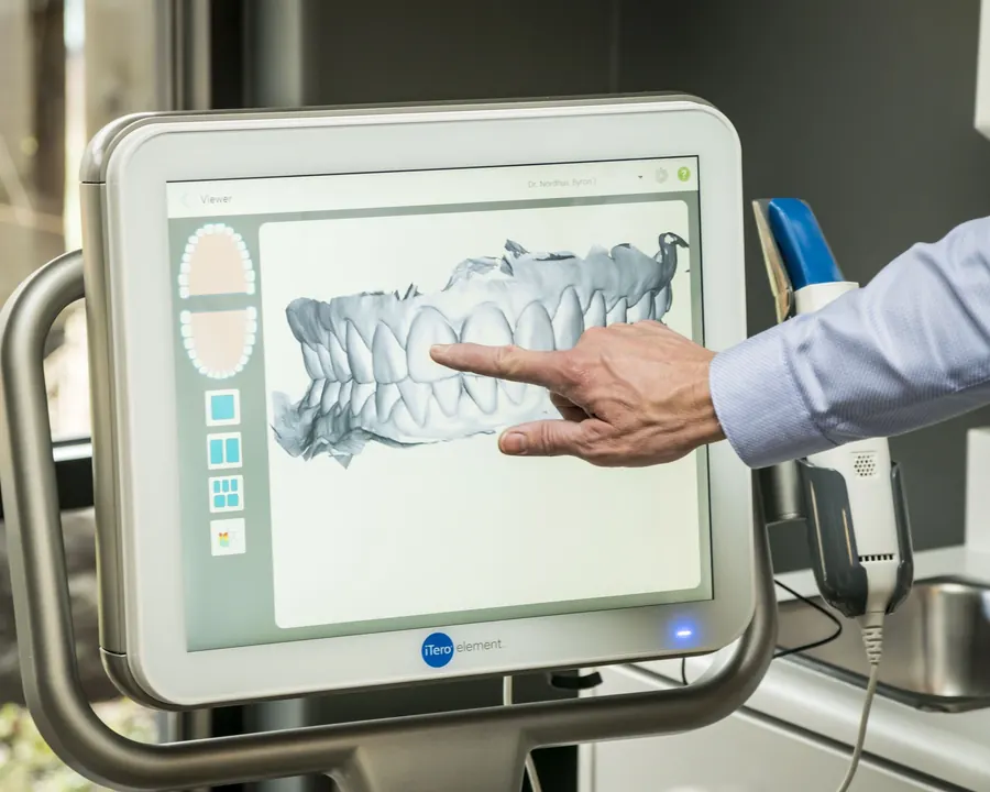 The iTero scanner screen at Nordhus Dentistry, showing a 3-D scan of a patient's teeth.